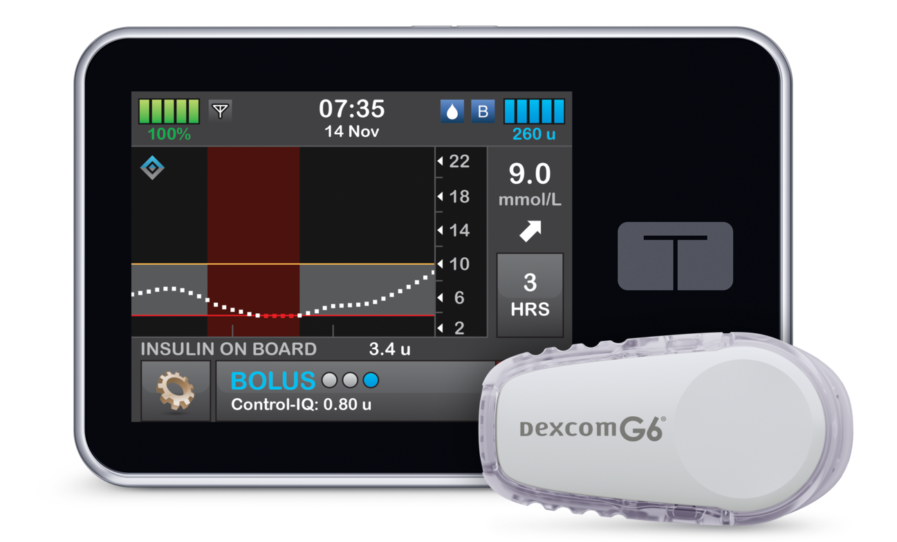 t:slim Control-IQ and Dexcom G6