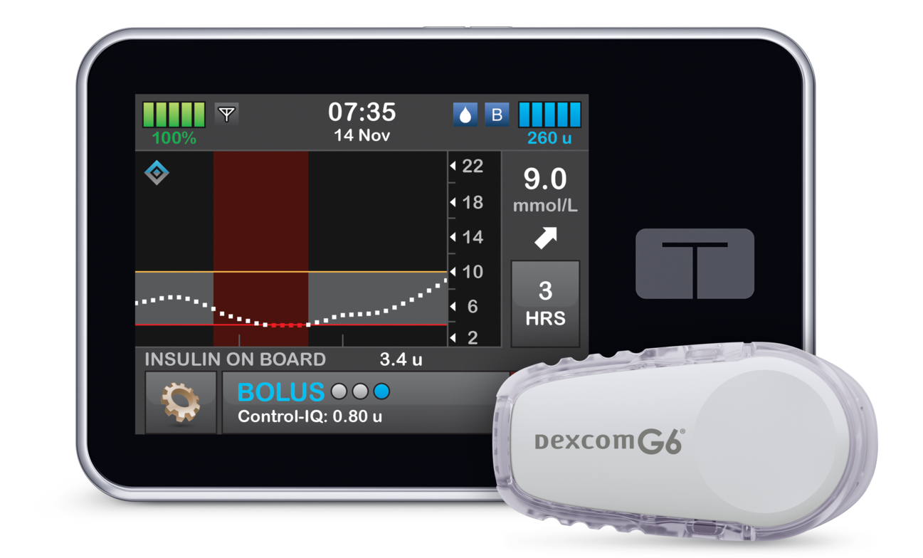 t:slim Control-IQ and Dexcom G6